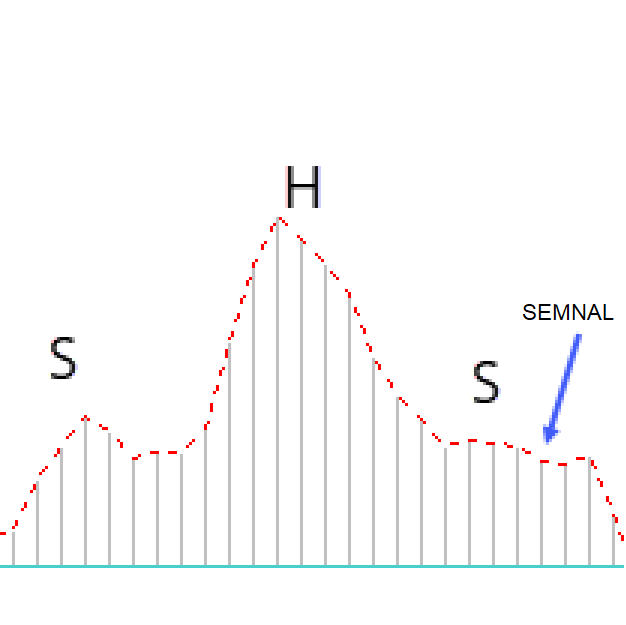 Bearish MACD SHS (Head and Shoulder)